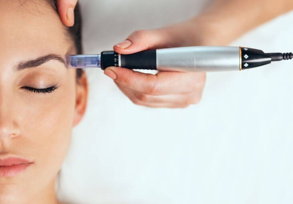 dermapen regeneración de la piel
